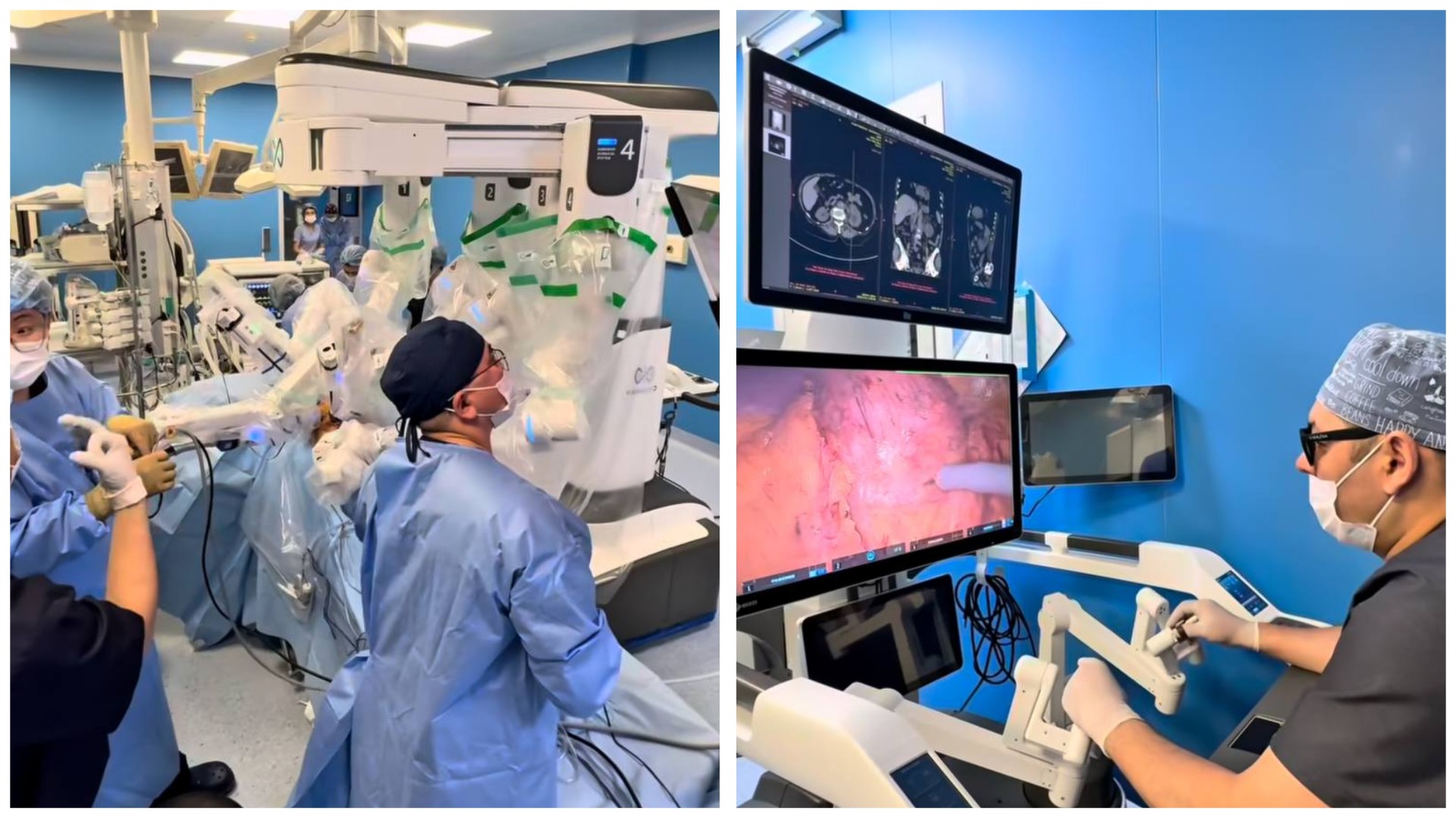 В Казахстане впервые успешно проведена роботизированная онкохирургическая операция