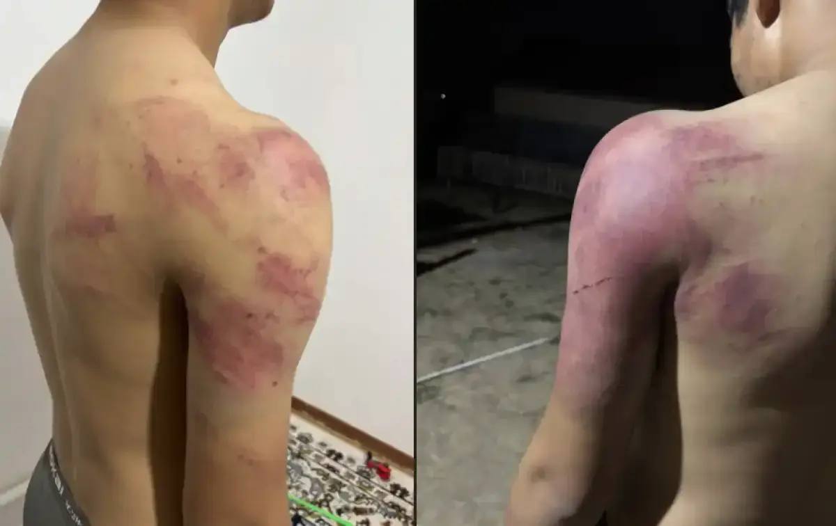 В Атырау задержаны лица, жестоко избившие подростка группой лиц.