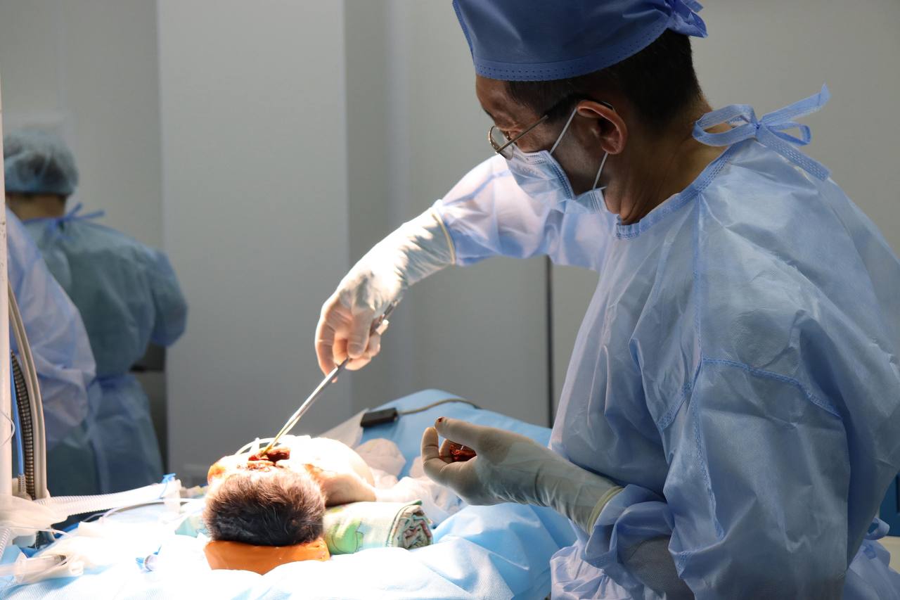 Не опухоль, а тень мозга: Алматинские врачи столкнулись с одной из самых редких патологий в мире