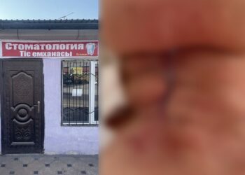 Жительница Ленгера столкнулась с тяжёлыми осложнениями после удаления зуба в неизвестной стоматологии