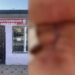 Жительница Ленгера столкнулась с тяжёлыми осложнениями после удаления зуба в неизвестной стоматологии