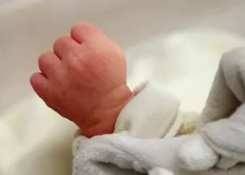 В Узбекистане родился младенец с четырьмя ногами