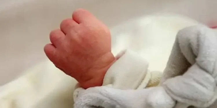 В Узбекистане родился младенец с четырьмя ногами